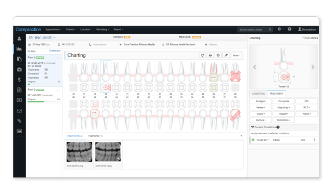 Interactive online dental charting