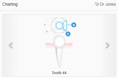 Focus on one tooth at a time with the detailed view