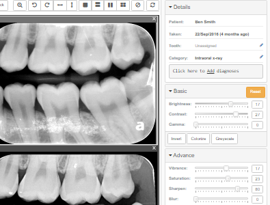 No hidden costs for our imaging module