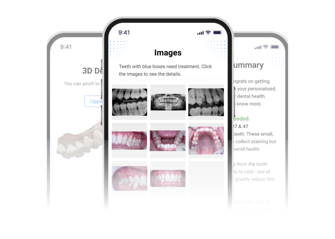 Smart X-ray Analysis